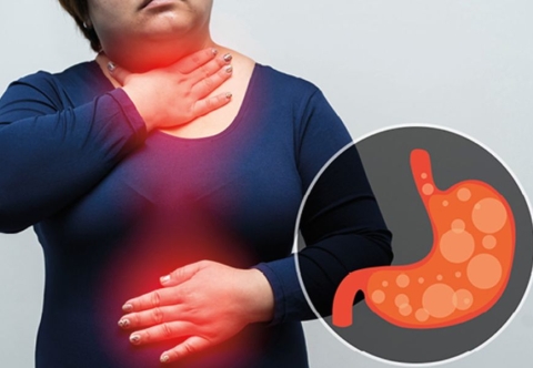 Kiểm soát cân nặng giảm nguy cơ ung thư thực quản